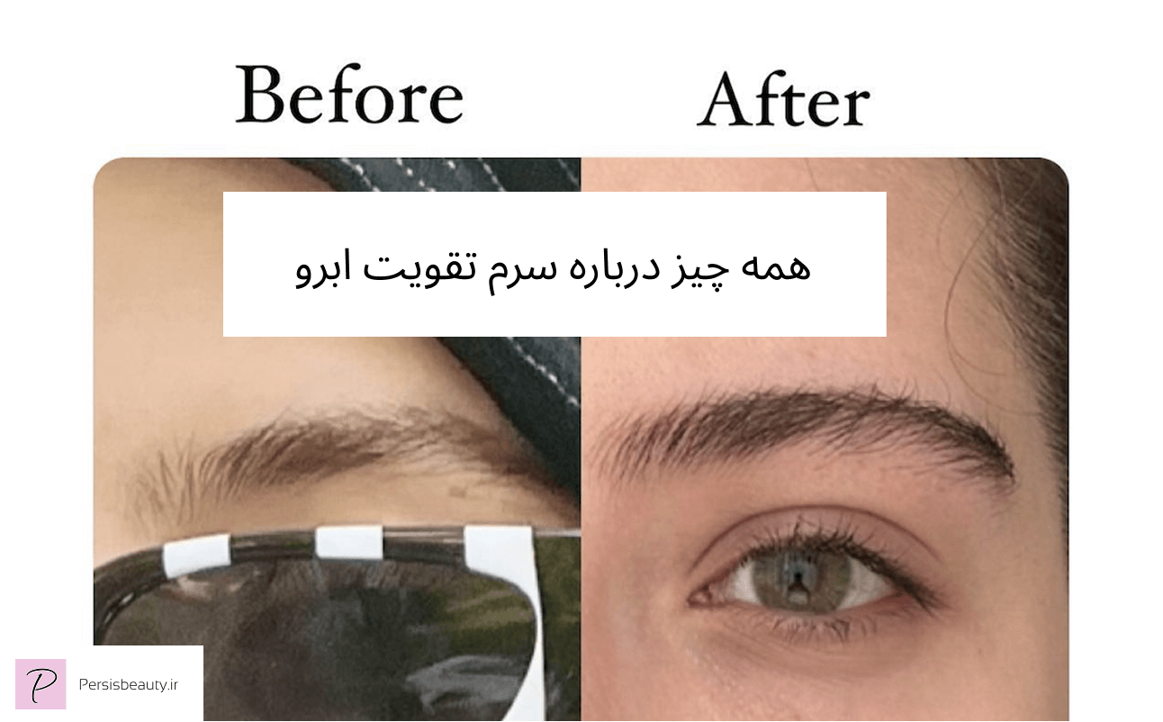 همه چیز درباره سرم تقویت ابرو گیاهی